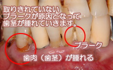 小林歯科クリニックでは患者の皆様に丁寧なブラッシング指導を行います